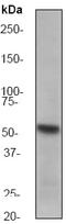 Tryptophan Hydroxylase 1 antibody, ab52954, Abcam, Western Blot image 
