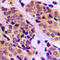 Mitogen-Activated Protein Kinase Kinase Kinase 5 antibody, LS-C354042, Lifespan Biosciences, Immunohistochemistry frozen image 