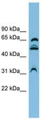 WD Repeat Domain 1 antibody, TA344093, Origene, Western Blot image 