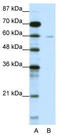 Decapping MRNA 1A antibody, TA345251, Origene, Western Blot image 