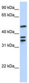 ETV6 antibody, TA330077, Origene, Western Blot image 