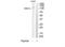 Origin Recognition Complex Subunit 1 antibody, TA314309, Origene, Western Blot image 