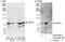 ATP Binding Cassette Subfamily F Member 3 antibody, A302-496A, Bethyl Labs, Immunoprecipitation image 