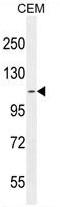 ATPase Phospholipid Transporting 8B2 antibody, AP50280PU-N, Origene, Western Blot image 