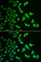 Dehydrogenase/Reductase 2 antibody, 22-229, ProSci, Immunofluorescence image 