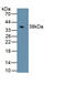 Metallothionein 1E antibody, LS-C663186, Lifespan Biosciences, Western Blot image 