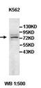 ATP Binding Cassette Subfamily F Member 3 antibody, orb77652, Biorbyt, Western Blot image 