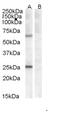 ATPase 13A1 antibody, 46-629, ProSci, Western Blot image 