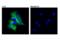 Microtubule Associated Protein Tau antibody, 46687S, Cell Signaling Technology, Immunocytochemistry image 