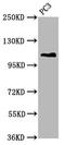 FANCD2 And FANCI Associated Nuclease 1 antibody, CSB-PA22859A0Rb, Cusabio, Western Blot image 