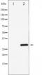 Cyclin Dependent Kinase 2 antibody, TA325344, Origene, Western Blot image 