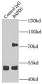 Terminal Nucleotidyltransferase 4B antibody, FNab06139, FineTest, Immunoprecipitation image 