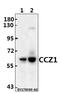 CCZ1 Homolog, Vacuolar Protein Trafficking And Biogenesis Associated antibody, GTX66826, GeneTex, Western Blot image 