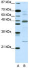 NFKB Inhibitor Beta antibody, TA335823, Origene, Western Blot image 