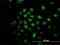 Calcium Responsive Transcription Factor antibody, H00079800-M01, Novus Biologicals, Immunofluorescence image 