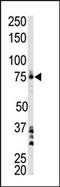 Bruton Tyrosine Kinase antibody, AP14458PU-N, Origene, Western Blot image 