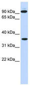 Exostosin Glycosyltransferase 2 antibody, TA335230, Origene, Western Blot image 