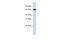 Zinc Finger Protein 775 antibody, 25-033, ProSci, Western Blot image 