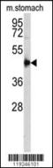 Cathepsin E antibody, 62-330, ProSci, Western Blot image 