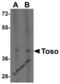 Fc Fragment Of IgM Receptor antibody, 2273, ProSci Inc, Western Blot image 