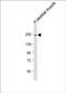 Myosin-2 antibody, PA5-72278, Invitrogen Antibodies, Western Blot image 