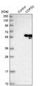 COP9 Signalosome Subunit 2 antibody, NBP1-90189, Novus Biologicals, Western Blot image 