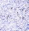 Vegi antibody, A02402-1, Boster Biological Technology, Immunohistochemistry frozen image 