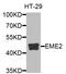 Probable crossover junction endonuclease EME2 antibody, STJ111933, St John