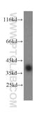 Hyaluronan-binding protein 2 antibody, 12863-1-AP, Proteintech Group, Western Blot image 