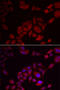 Phosphoinositide Kinase, FYVE-Type Zinc Finger Containing antibody, 22-407, ProSci, Immunofluorescence image 
