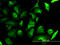 Lactate Dehydrogenase B antibody, LS-B4366, Lifespan Biosciences, Immunofluorescence image 