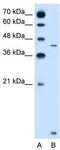 Solute Carrier Family 46 Member 3 antibody, TA334625, Origene, Western Blot image 