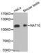 N-Acetyltransferase 10 antibody, abx004598, Abbexa, Western Blot image 