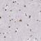 Histone-lysine N-methyltransferase SETD1A antibody, PA5-54254, Invitrogen Antibodies, Immunohistochemistry paraffin image 