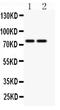 P2X purinoceptor 4 antibody, PA2127, Boster Biological Technology, Western Blot image 