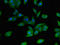 F-Box Protein 9 antibody, orb47247, Biorbyt, Immunocytochemistry image 