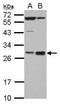Hematopoietically-expressed homeobox protein HHEX antibody, PA5-29154, Invitrogen Antibodies, Western Blot image 