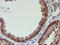 Proteasome 26S Subunit, Non-ATPase 2 antibody, TA503217, Origene, Immunohistochemistry paraffin image 