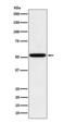 Immunoglobulin Heavy Constant Gamma 2 (G2m Marker) antibody, M07865-1, Boster Biological Technology, Western Blot image 