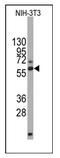 Dihydropyrimidinase Like 2 antibody, AM11031SU-N, Origene, Western Blot image 