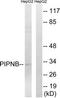 Phosphatidylinositol Transfer Protein Beta antibody, TA315271, Origene, Western Blot image 