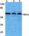 T-Box 18 antibody, PA5-37070, Invitrogen Antibodies, Western Blot image 