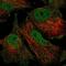 Zinc Finger Protein 606 antibody, PA5-59689, Invitrogen Antibodies, Immunofluorescence image 