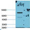 Luciferase antibody, LS-C813709, Lifespan Biosciences, Western Blot image 