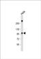 Zinc Finger CCHC-Type Containing 14 antibody, PA5-48612, Invitrogen Antibodies, Western Blot image 