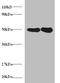 Dolichyl-diphosphooligosaccharide--protein glycosyltransferase subunit 1 antibody, A54001-100, Epigentek, Western Blot image 