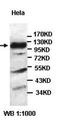 HECT And RLD Domain Containing E3 Ubiquitin Protein Ligase Family Member 6 antibody, orb77637, Biorbyt, Western Blot image 