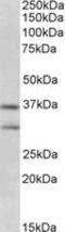 Fibroblast Growth Factor 23 antibody, MBS420602, MyBioSource, Western Blot image 