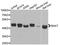 Bile Acid-CoA:Amino Acid N-Acyltransferase antibody, A7646, ABclonal Technology, Western Blot image 