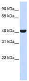 ERLIN2 antibody, TA344331, Origene, Western Blot image 